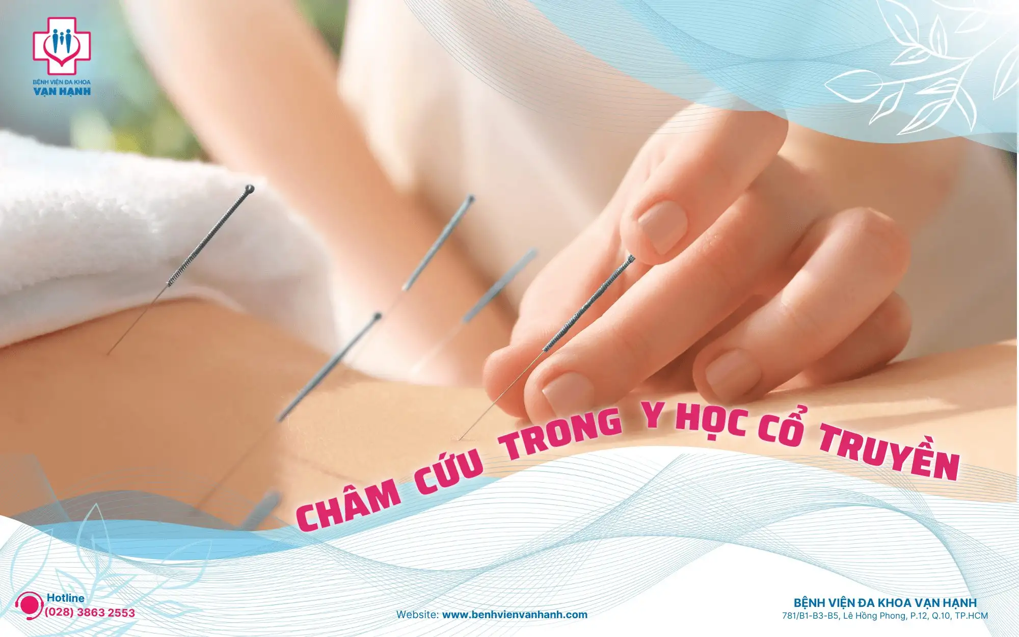 Vai trò của châm cứu trong chữa bệnh mạn tính không dùng thuốc đông y